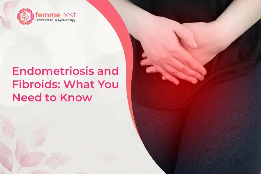 Endometriosis and Fibroids: What You Need to Know