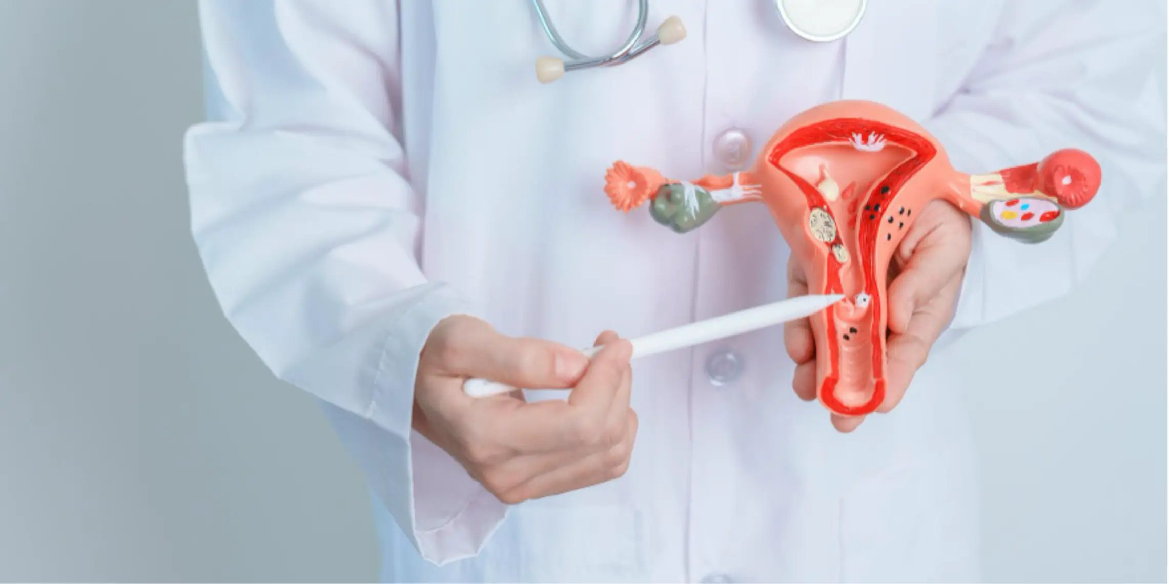 Hysteroscopic Polypectomy Surgery Cost in Delhi | Femmenest